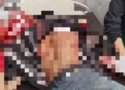 Tukang Ojek Jadi Korban Penganiayaan OTK di Waghete II, Satgas Ops Damai Cartenz Selidiki Pelaku